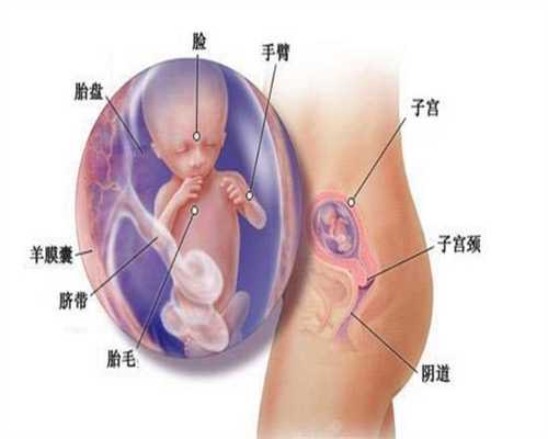 武汉专业代孕中心,孕妇为什么要做NT检查最佳时