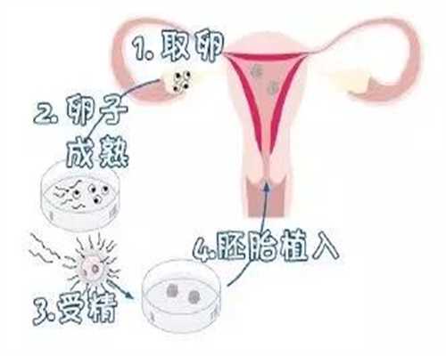 代孕费用医院中介_过期的早早孕测出阳性怎么回事