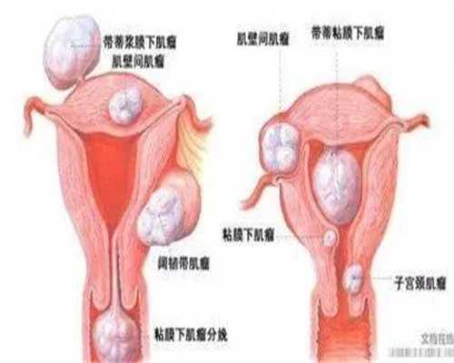 惠州供卵助孕集团-浙江供卵供卵怀孕13周（绝经供卵成功率多少）